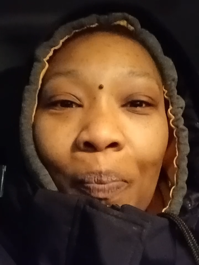 @Vitiligo_Diva
