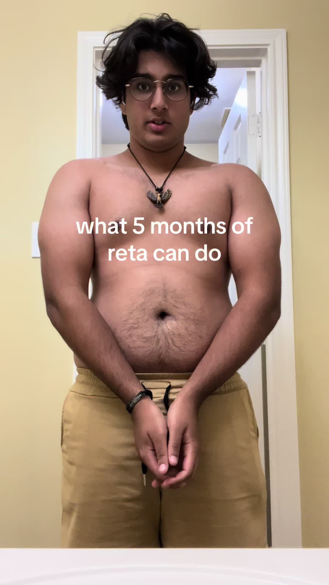 @Liam