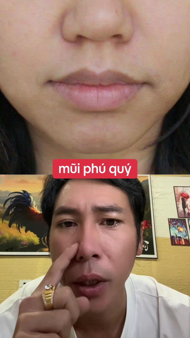 @Tuệ Nhãn ✅
