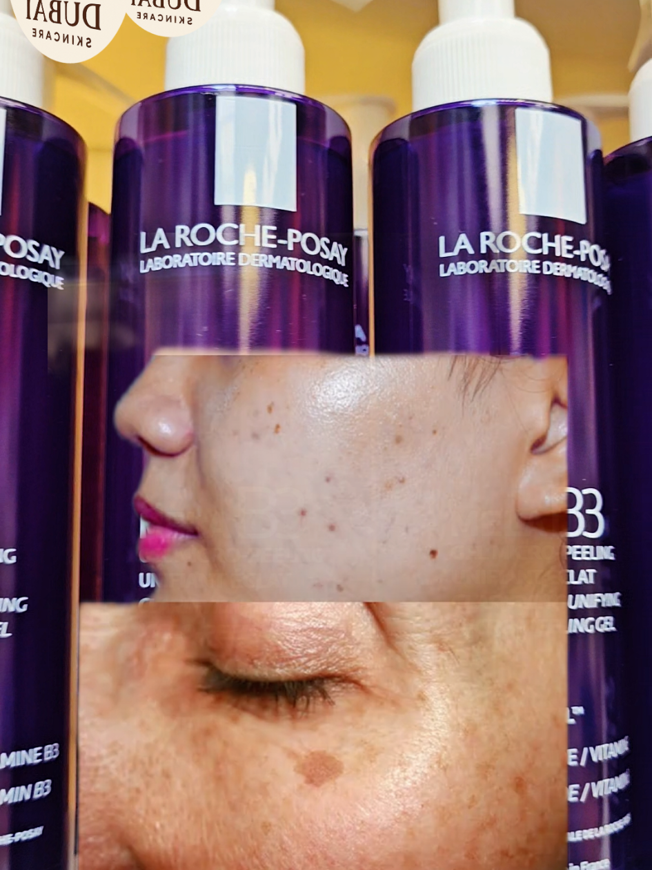@ኢትዮ-ዱባይ-Skincare 🇪🇹🇦🇪