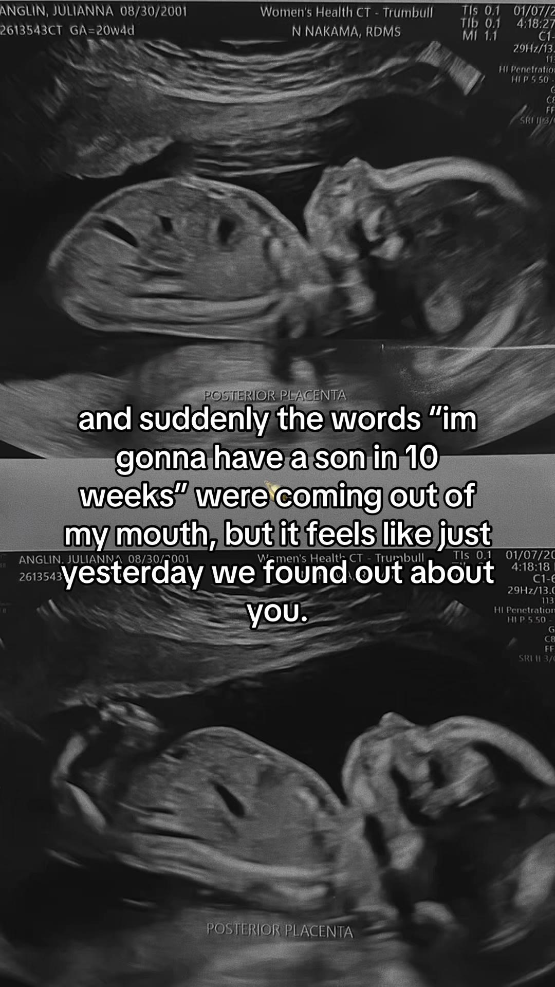 @jules 𝜗𝜚 | first time mom 🪿
