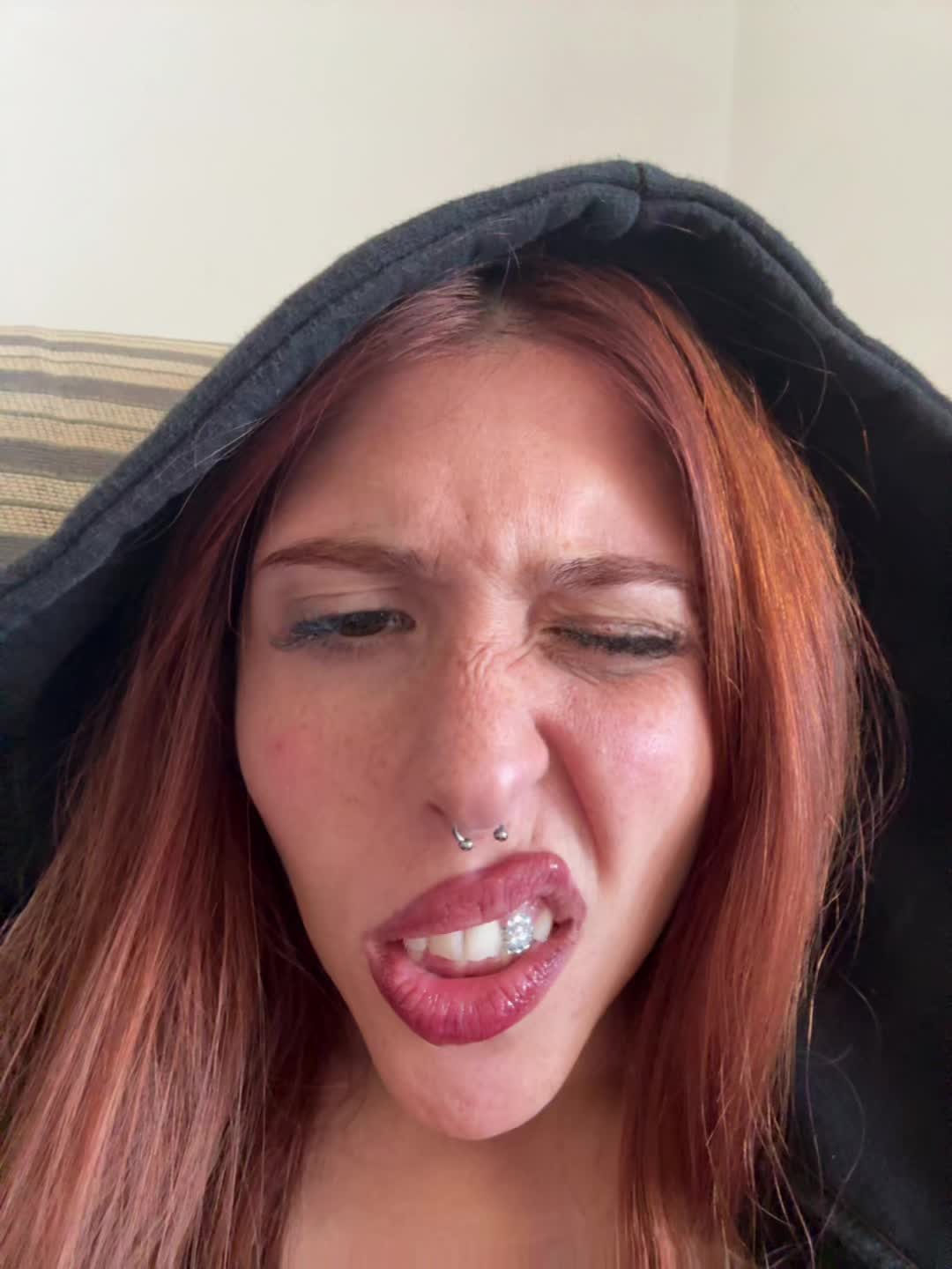 @ketoprophede