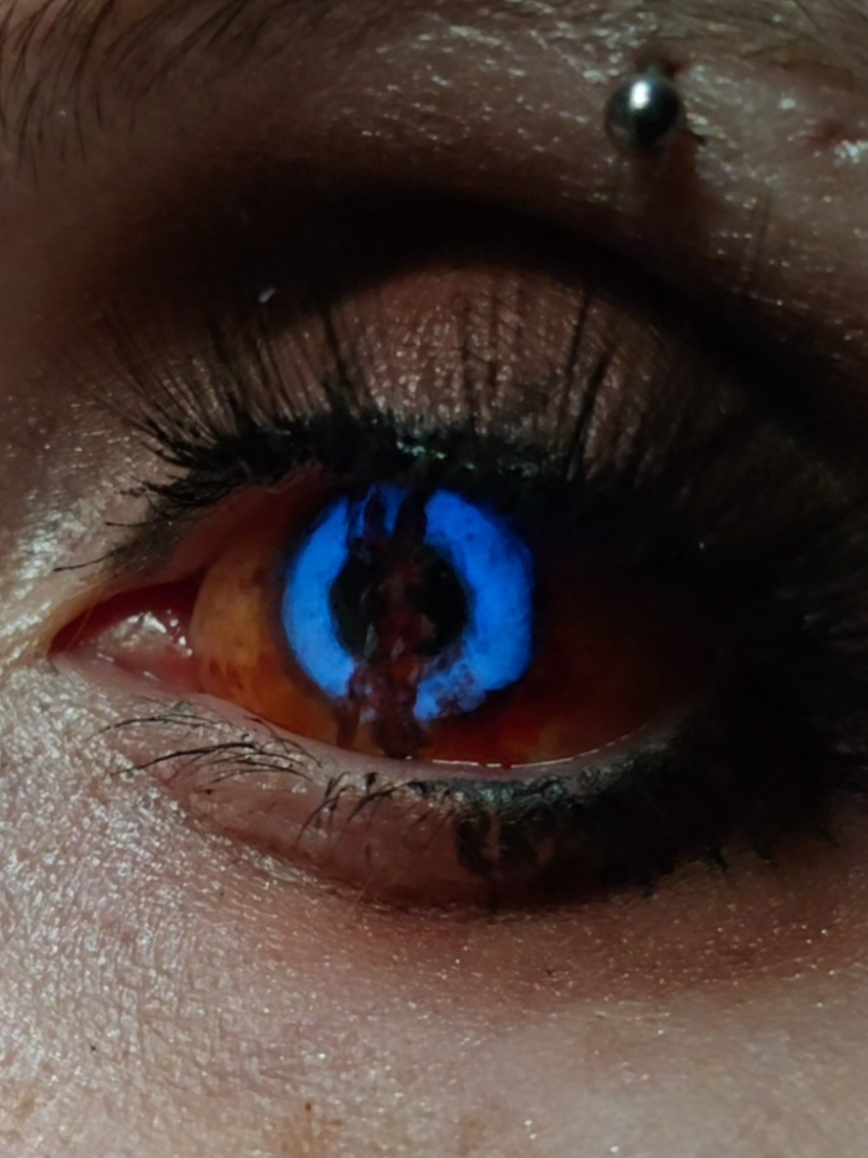 @EyeClops