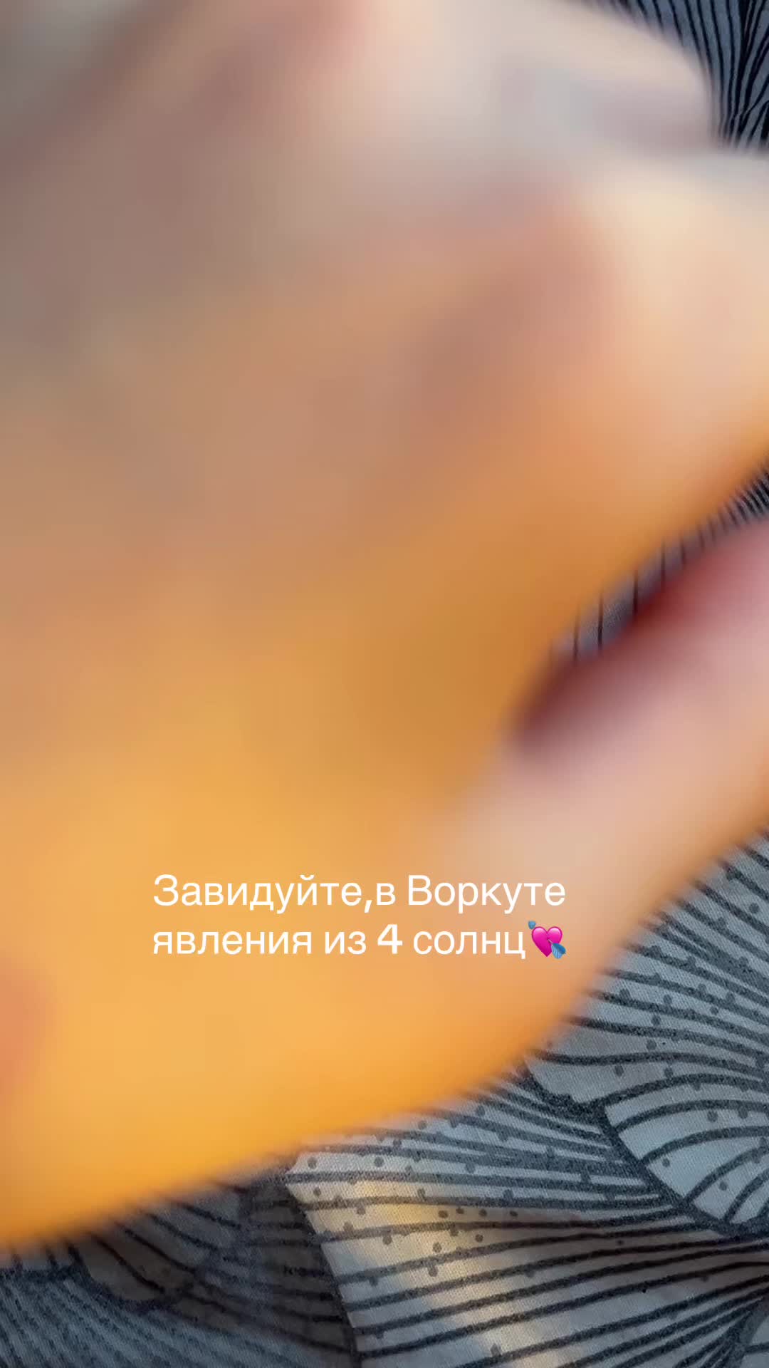 @melion.xxx🙇🏼♀️