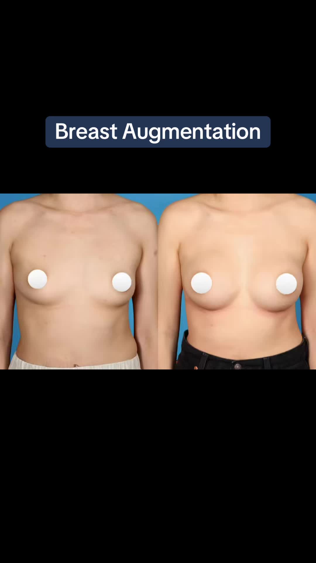 @Kelly Killeen, MD, FACS