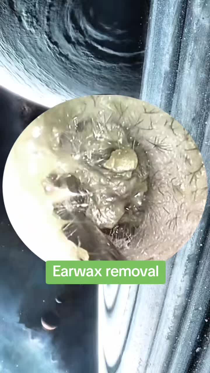 @Earwax.pro