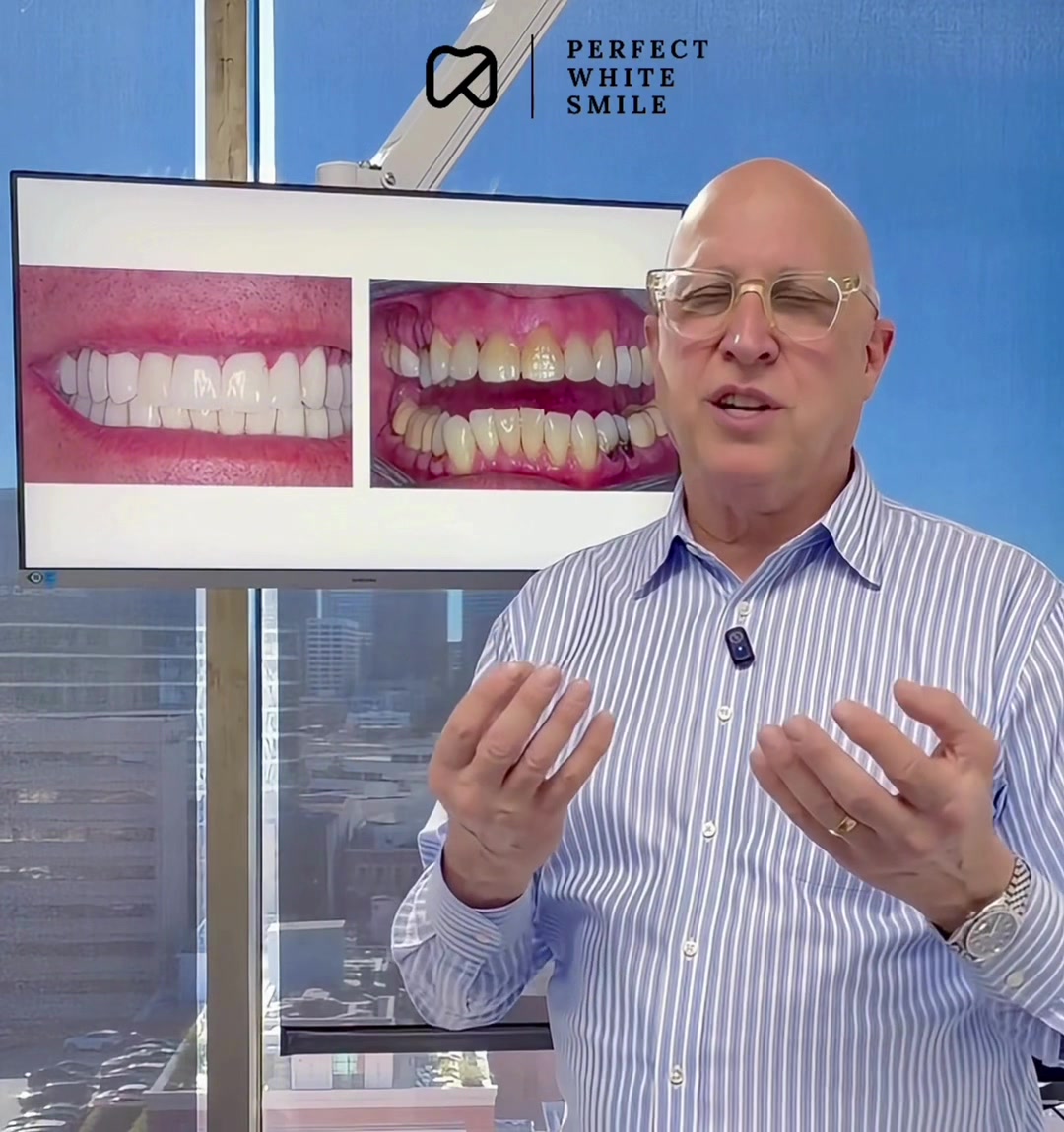 @Perfect White Smile/ Dr. Frey