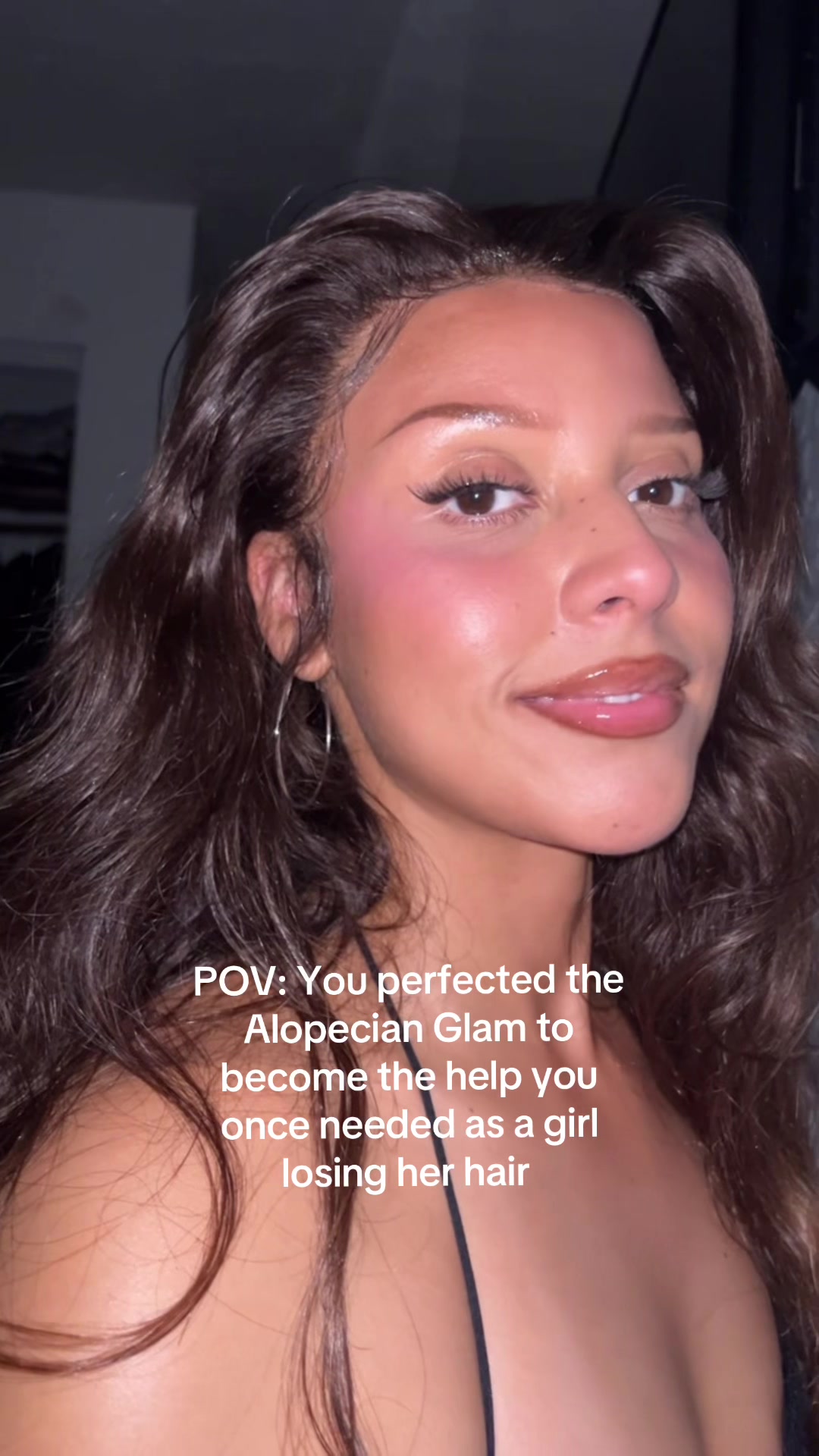 @AlopecianPrincess
