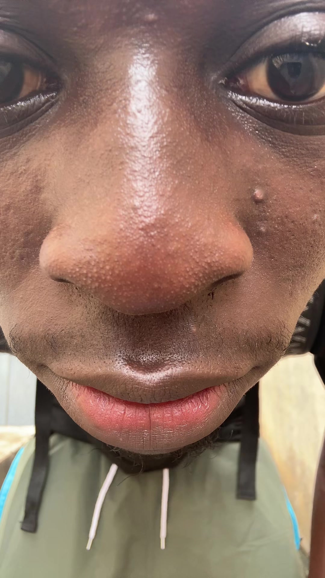 @LA MANO DU 229🚫🦵🏾
