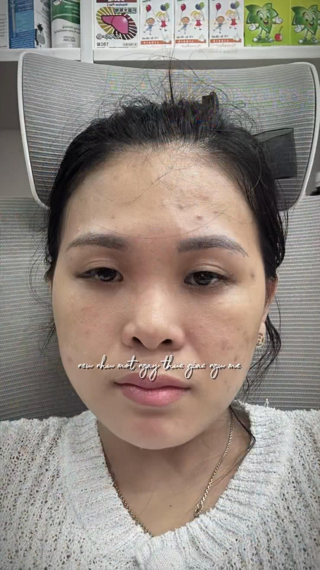 @Hoa Acne Skincare🌷