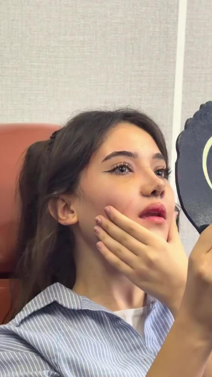 @Lor Cərrah Rinoplastika🌸✅