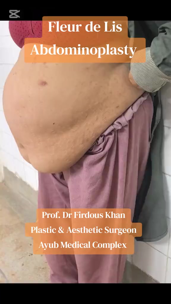 @Dr Firdous Khan PlasticSurgeon