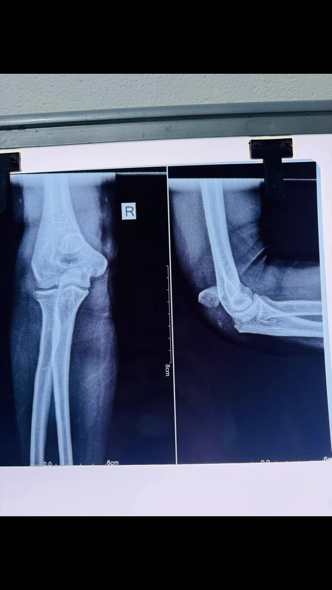 @Dr.Sanjay Gautam,Orthopedics🦴