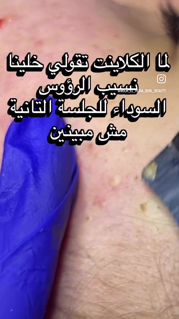 @ٍنور ٍ الهدي ٍميكب ٍارتسيت ✨