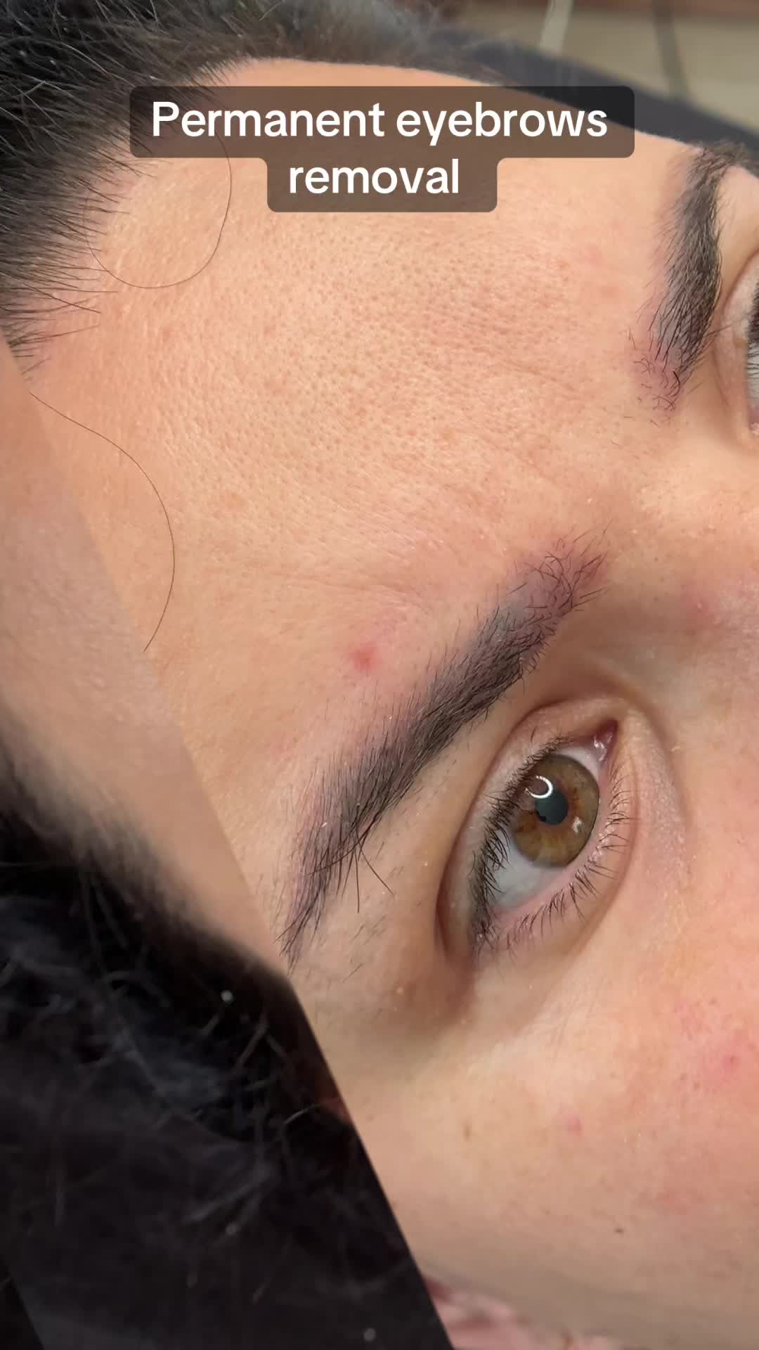 @Permanent Makeup & Removal