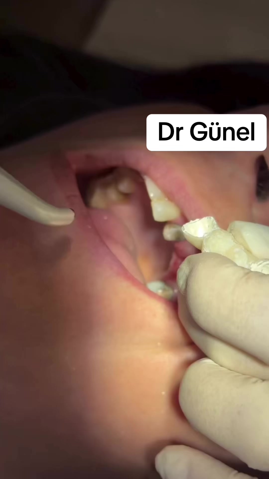 @Dentist_Günel