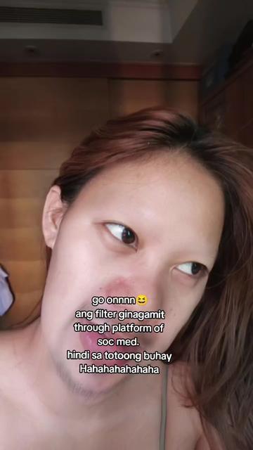 @887