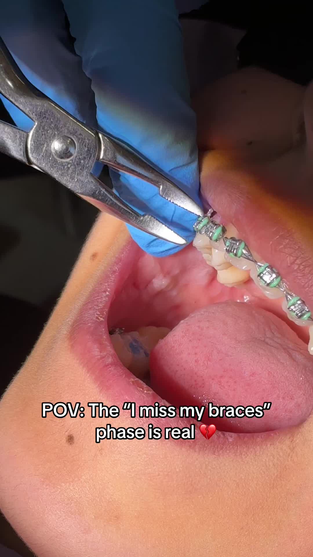 @Woodland Hills Orthodontist