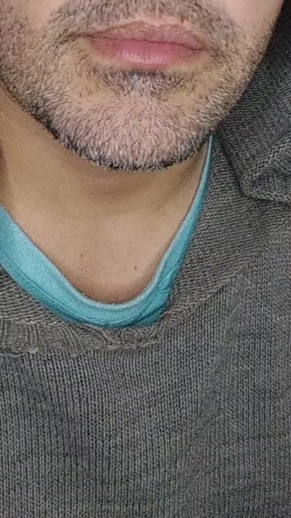 @Fabiano Lourenço