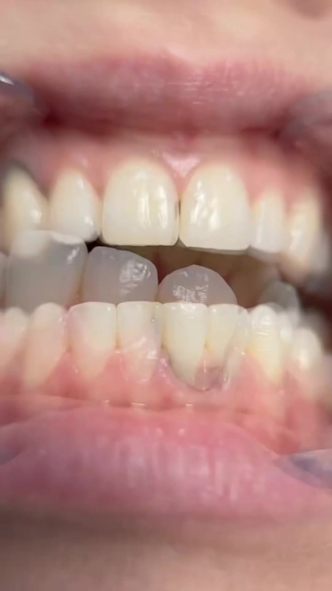 @puredentalhub