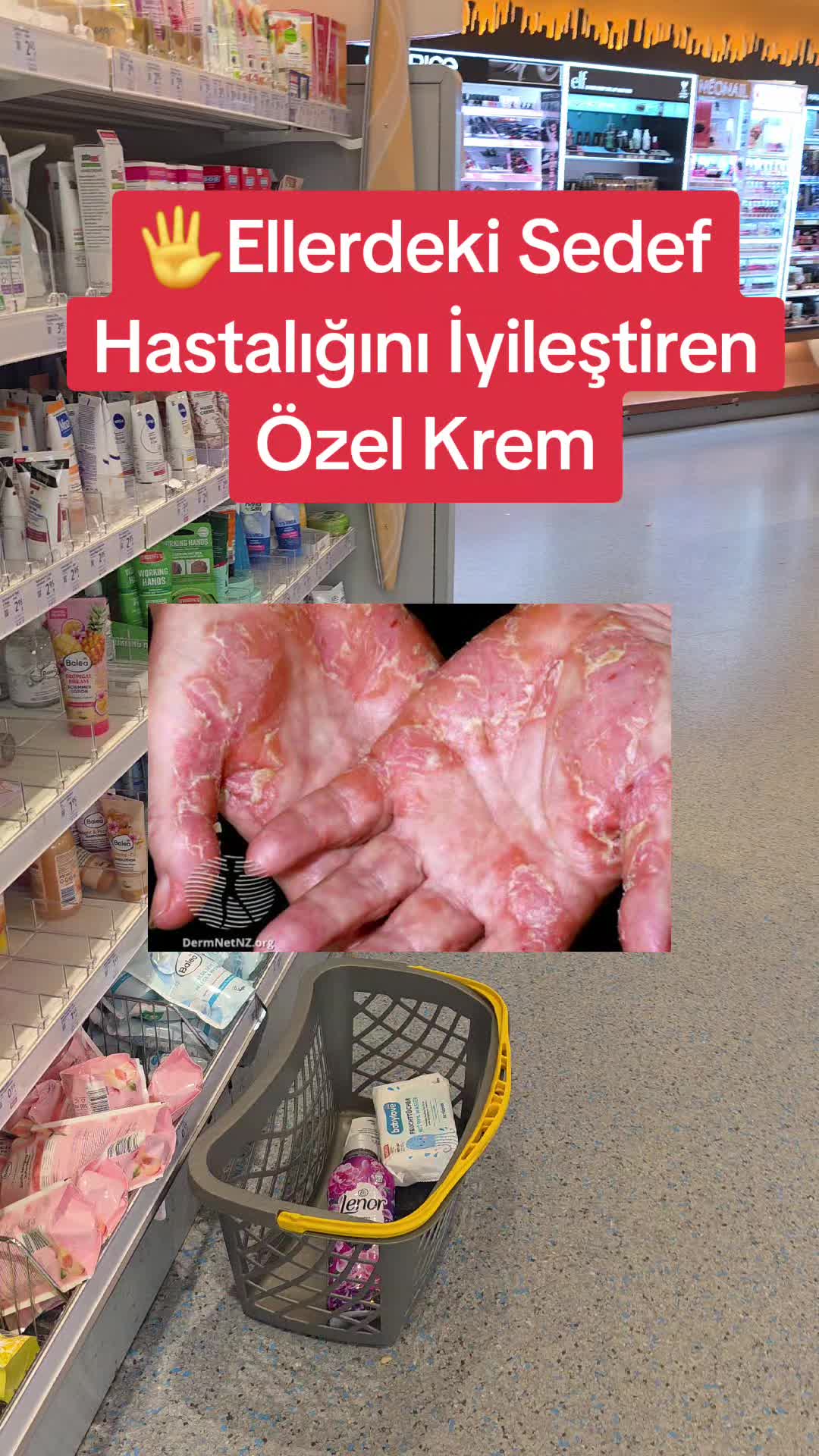 @Gurbetana27