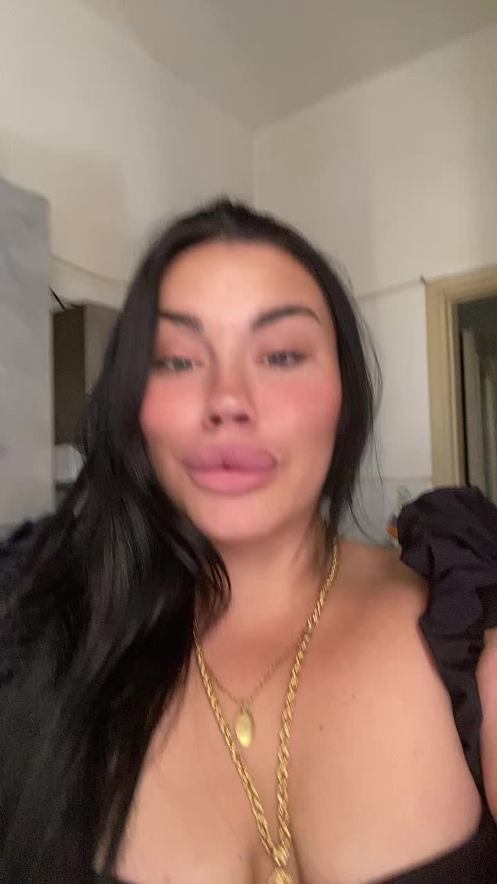 @Alessia albino