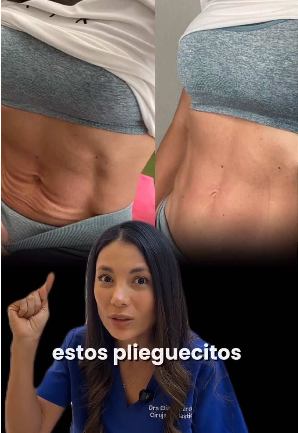 @Eliana Garc&eacute;s Plastic Surgery