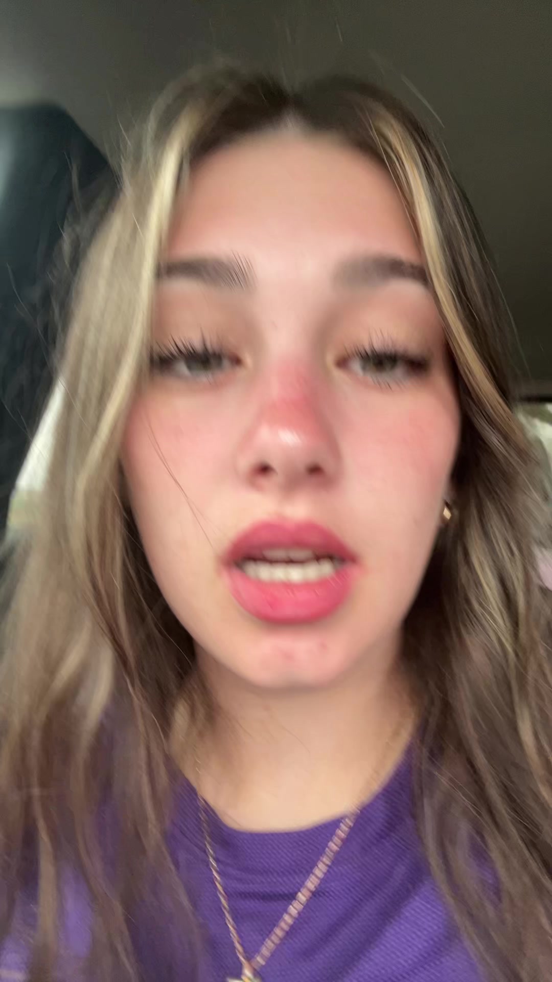 @em