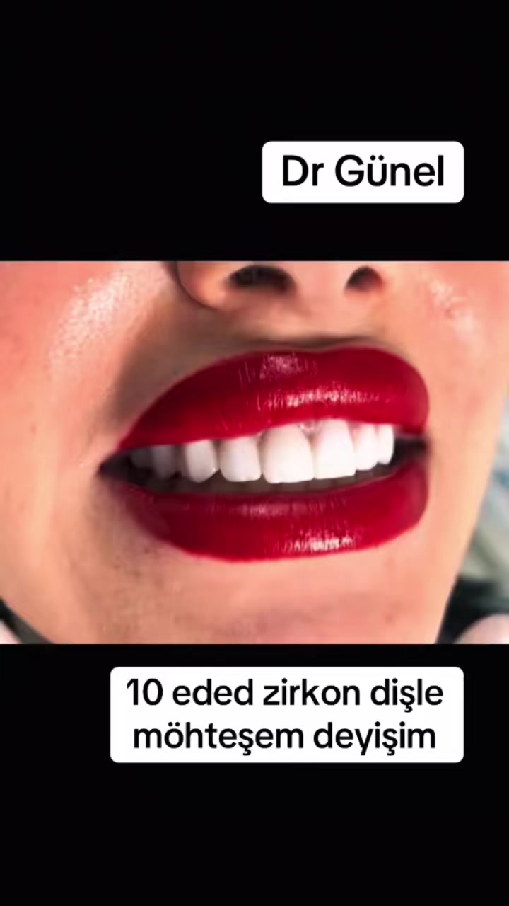 @Dentist_Günel