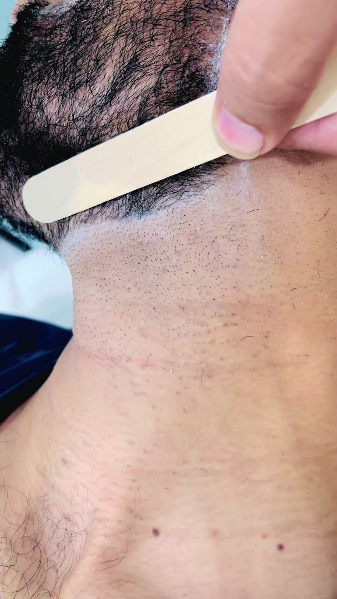 @Laser Grafix clinic
