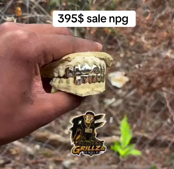 @Flawless Grillz
