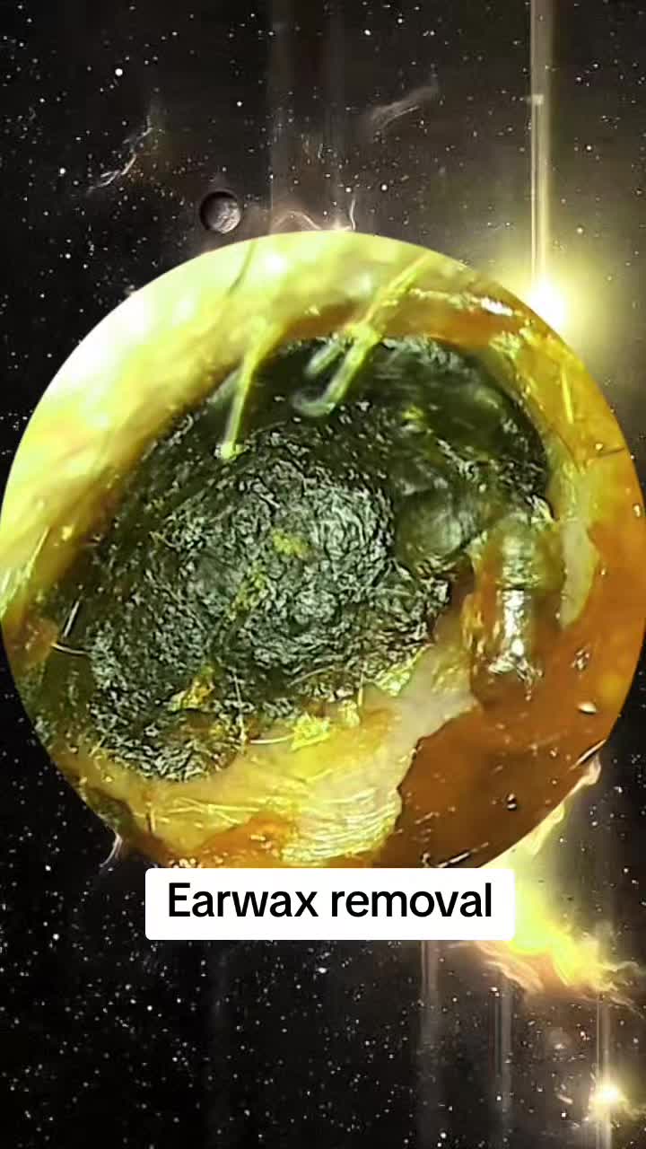 @Earwax.pro