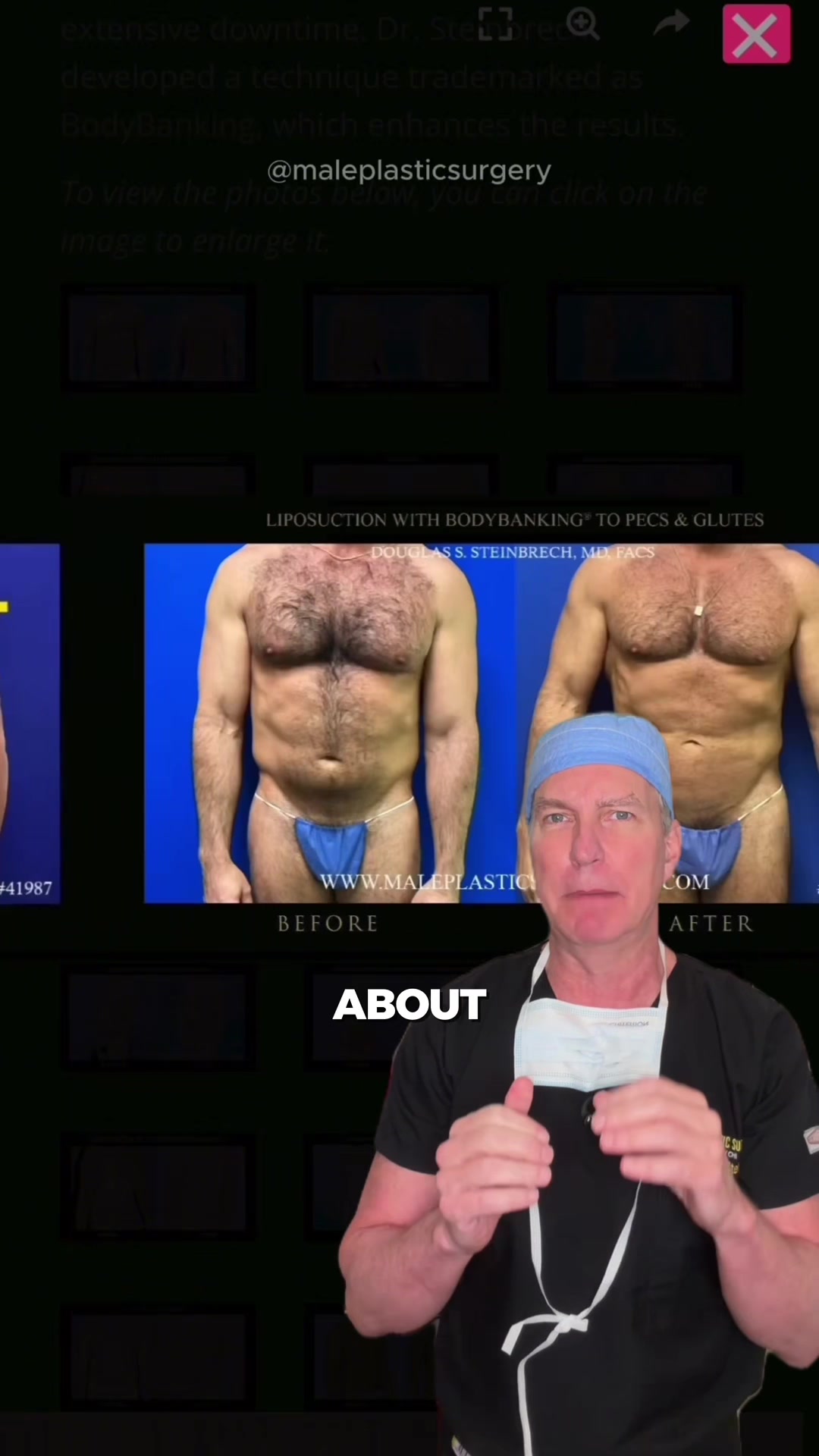 @mensplasticsurgery