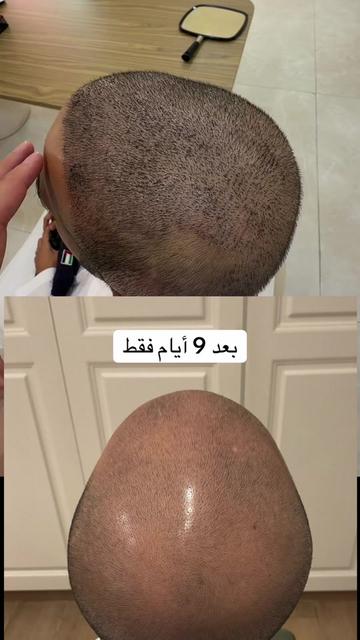 @Dr. Ahmed Alkhateeb