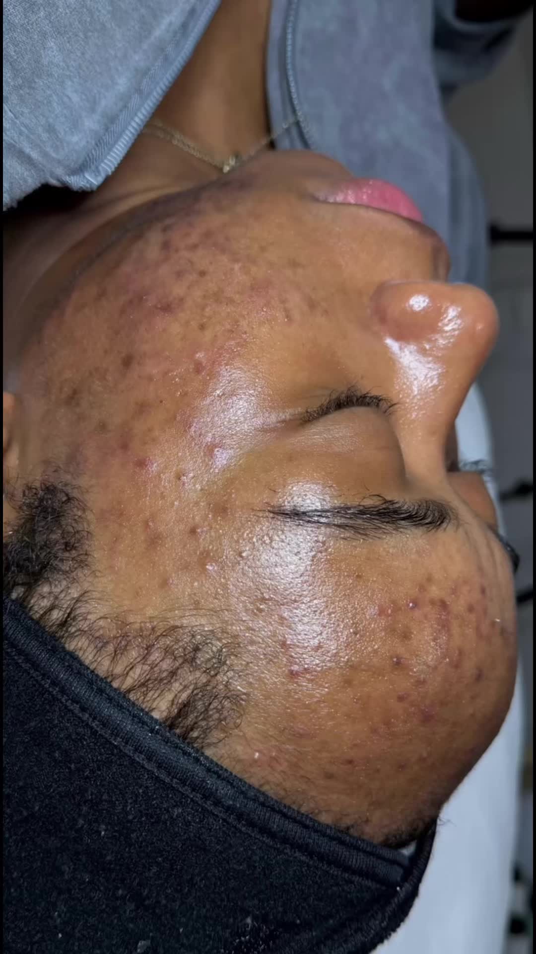 @Zee | Frisco Texas Esthetician