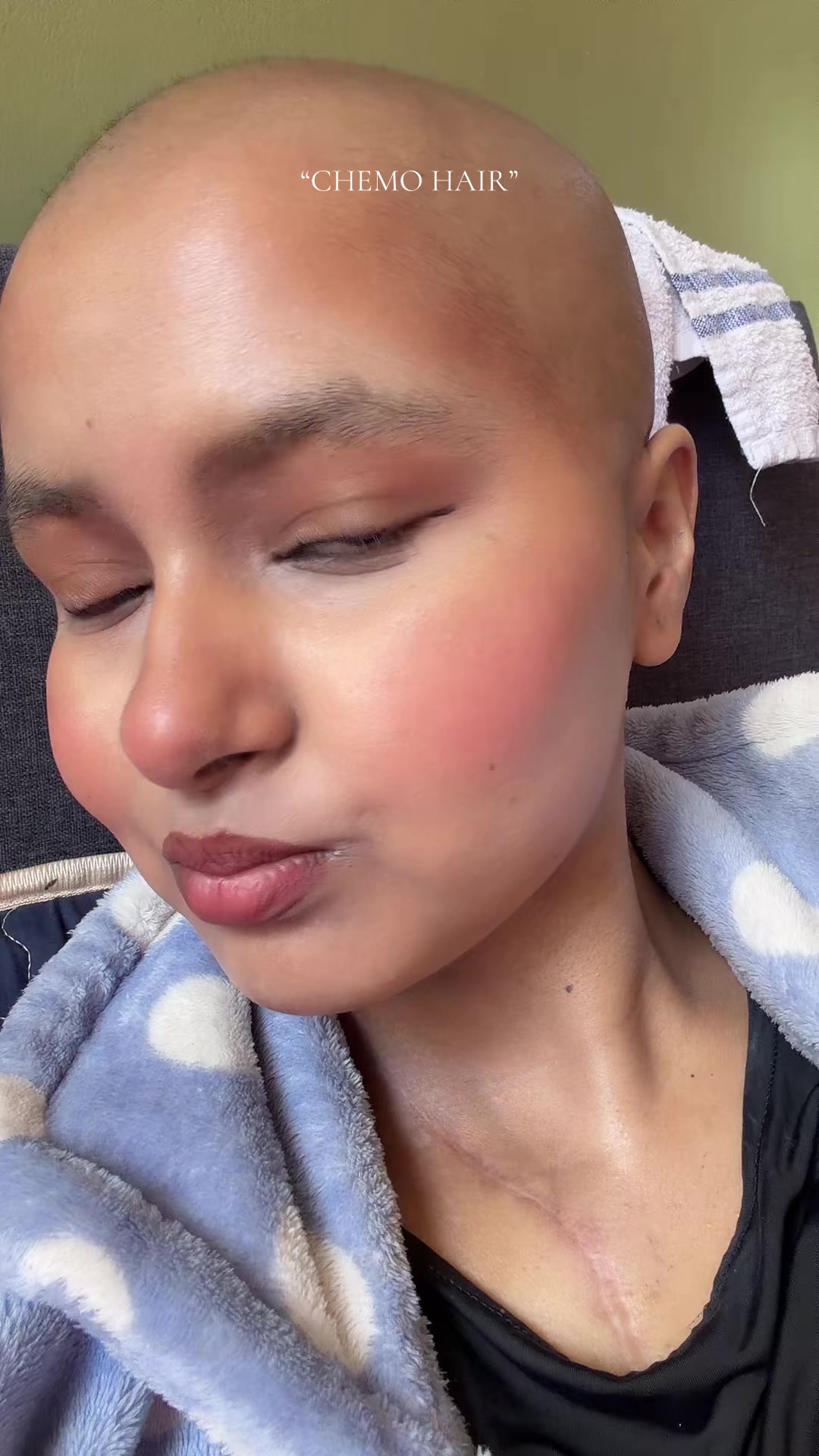 @Sneha🎗️