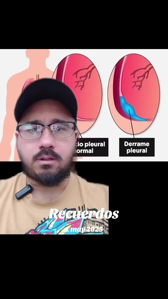 @Dr. Ajolote.
