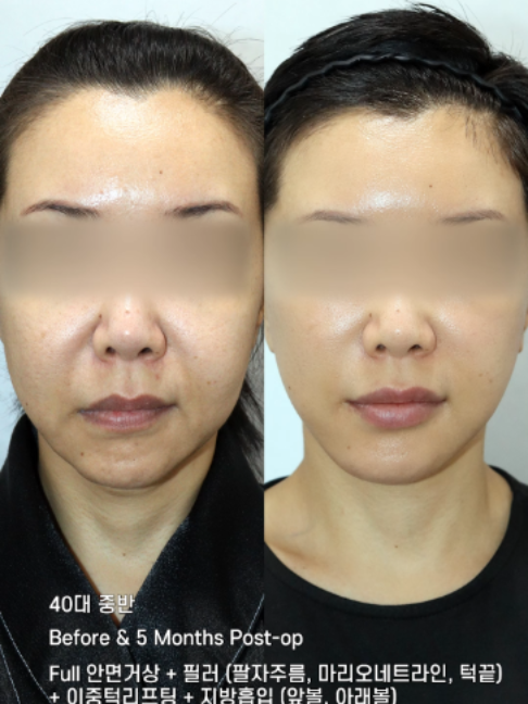 @다시피움성형외과 DASIPIUM タシピウム