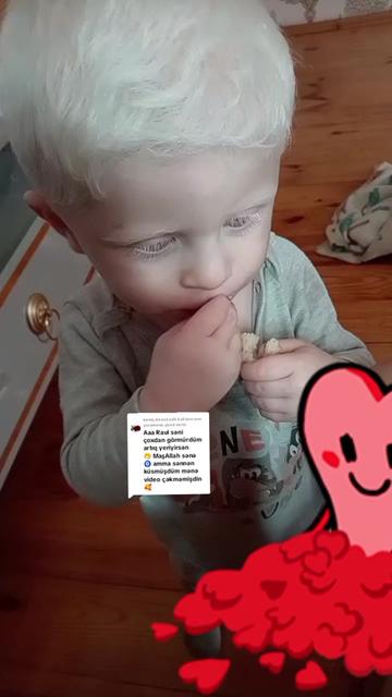 @🧸🤍ALBİNO🤍🧸🤍RAUL🤍🧸