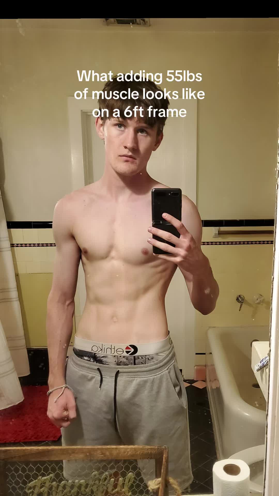 @Aidan