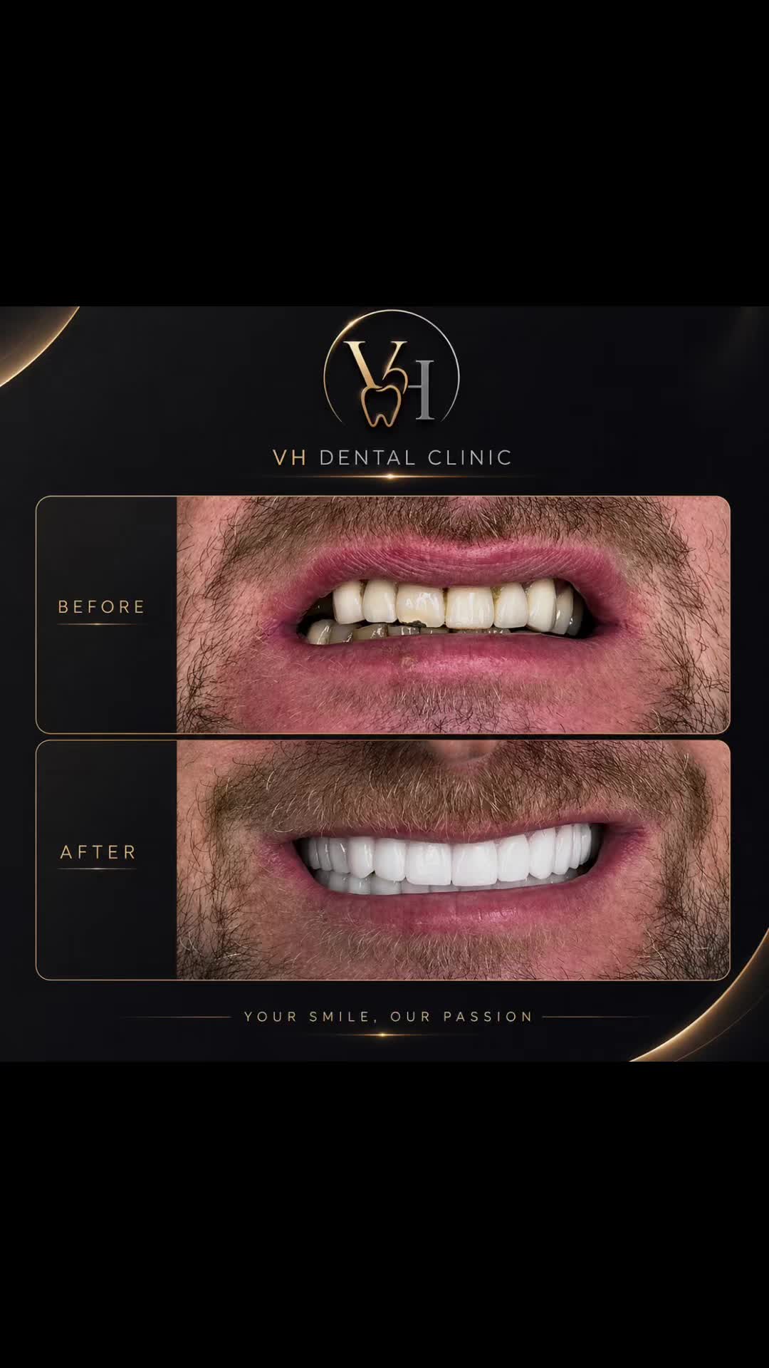 @drveton
