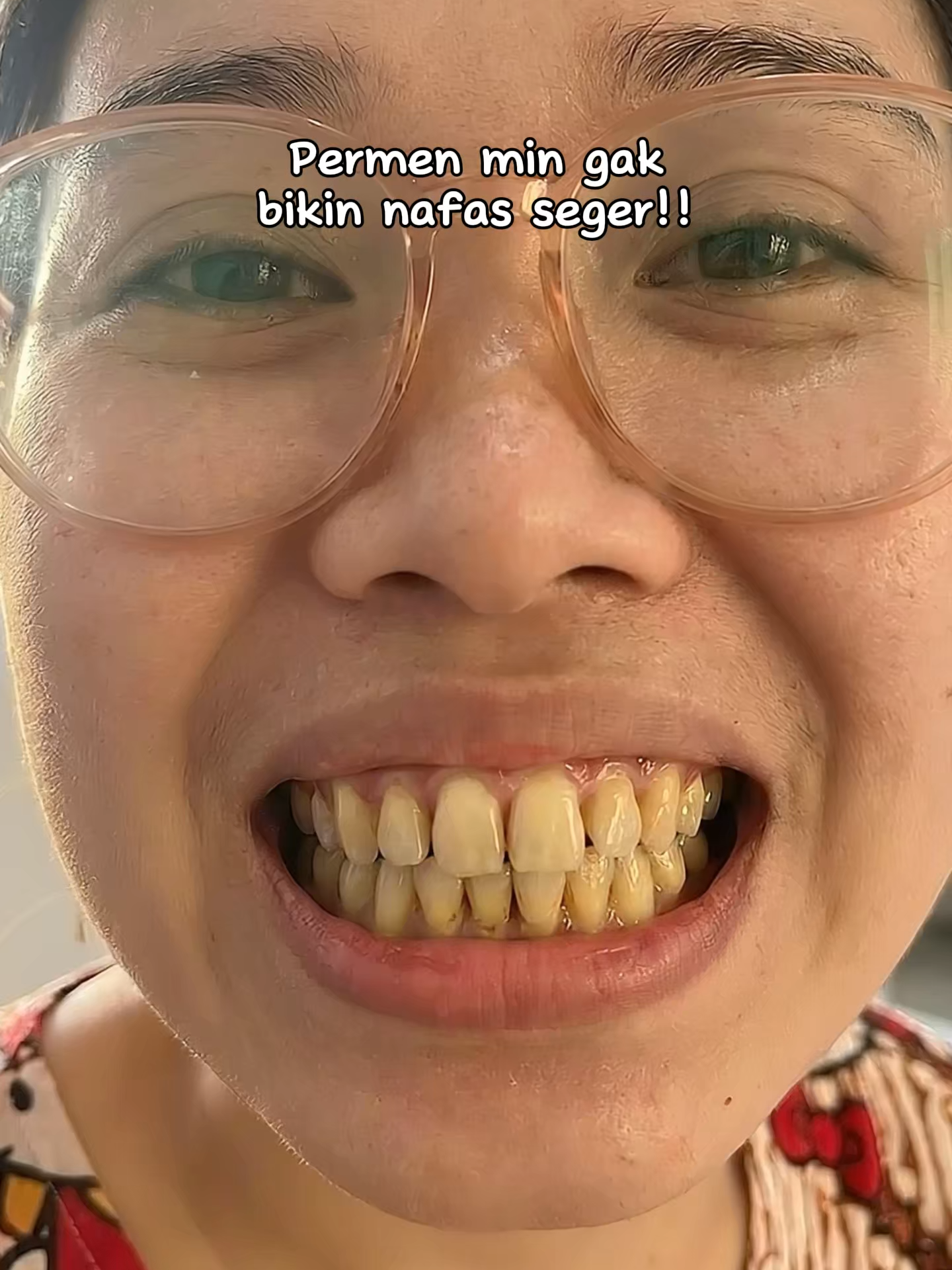 @ArunikaCare