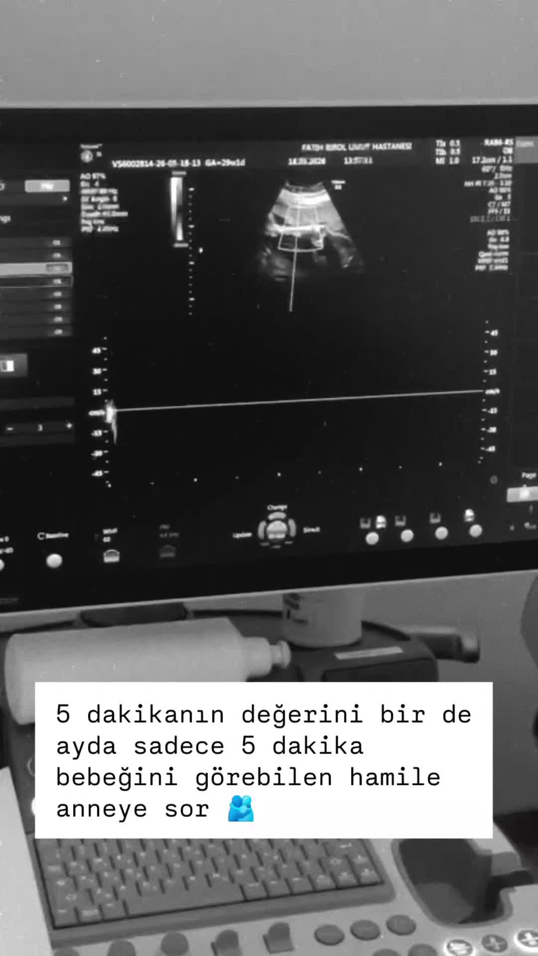 @gülo