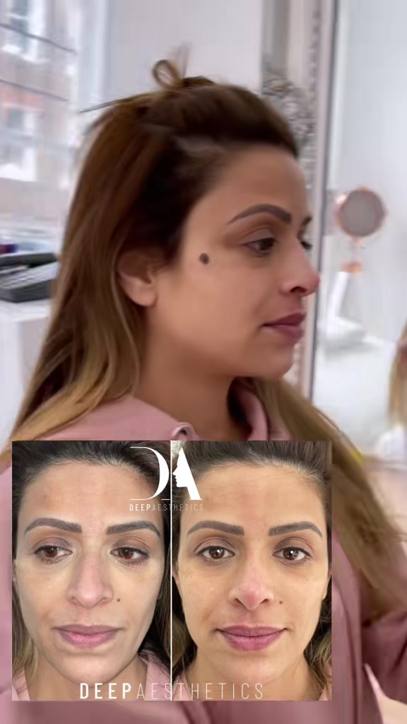 @deepaesthetics_official