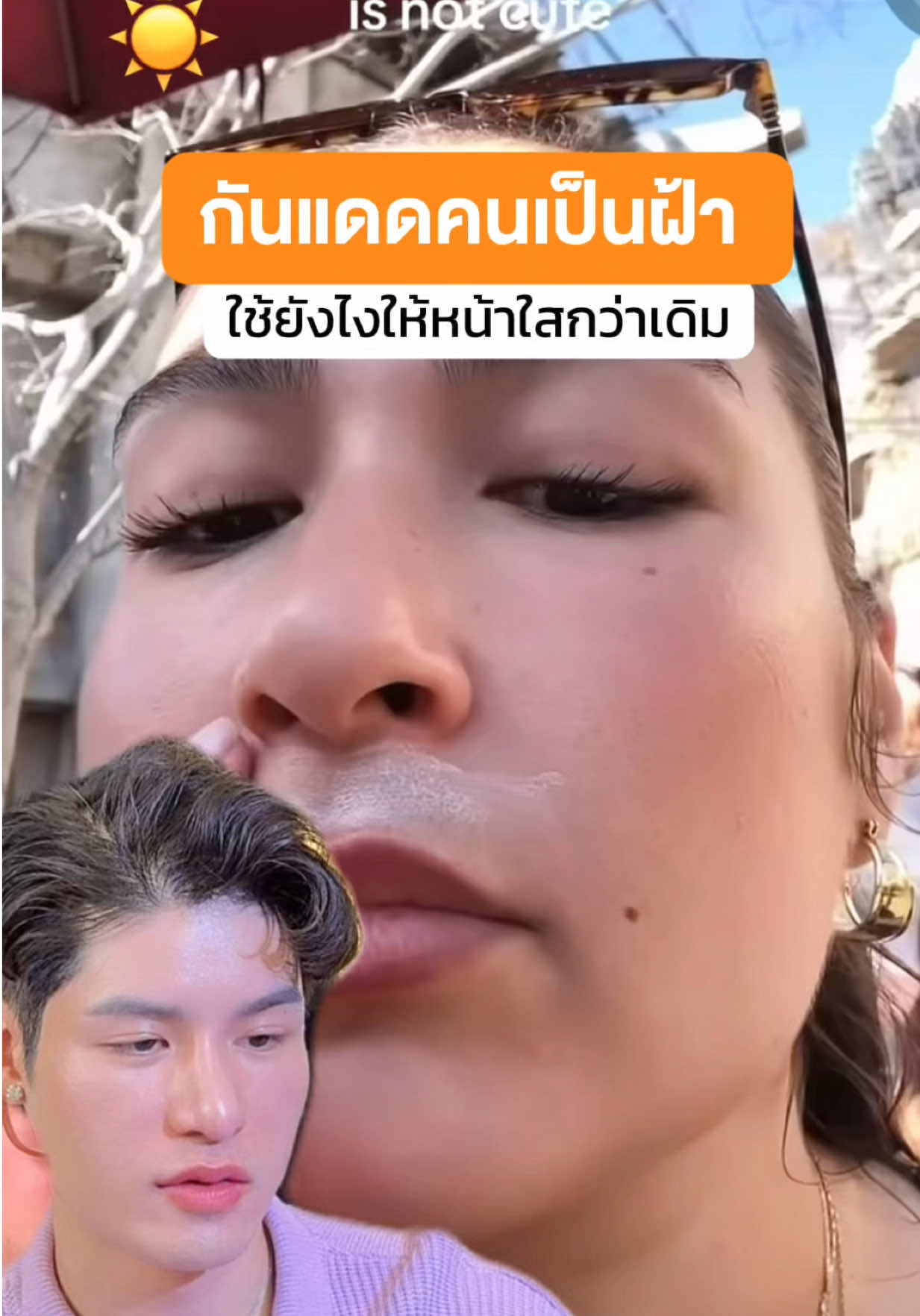 @หนูปอนด์ที่ชอบเลเซ่อร์