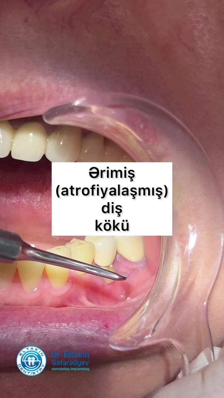 @eltakindentistry