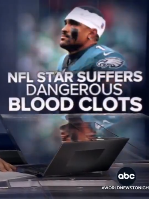 @ABC News