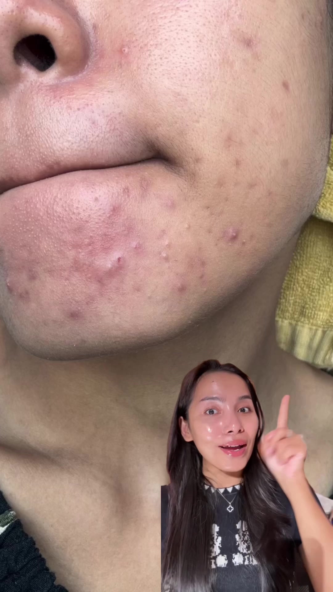 @Deenish_