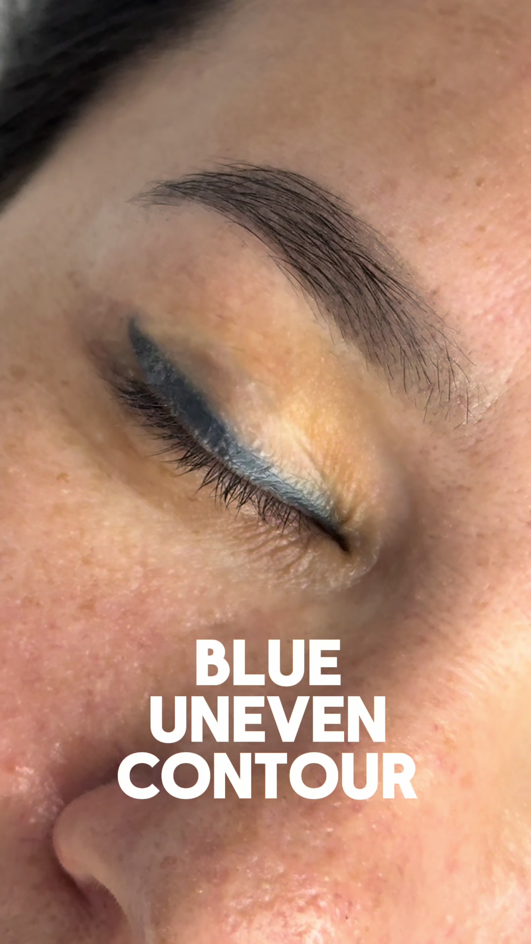 @Safe Eyebrows Tattoo Removal🗽