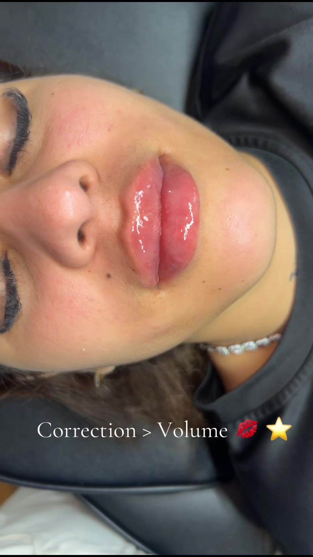 @injectormami